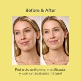 Acniben 2 Oily Skin CC+ Cream Light SPF30 40 ml.