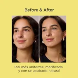Acniben 2 Oily Skin CC+ Cream Medium SPF30 40 ml.