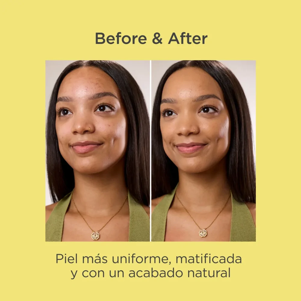 Acniben 2 Oily Skin CC+ Cream Bronze SPF30 40 ml.